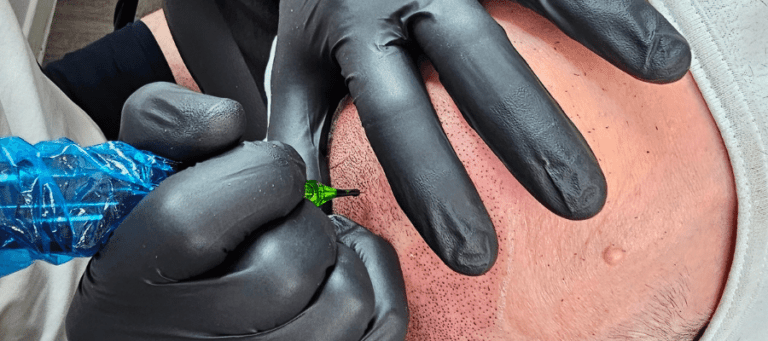 Natural-Looking SMP Results for Men - Tailored Ink Toronto