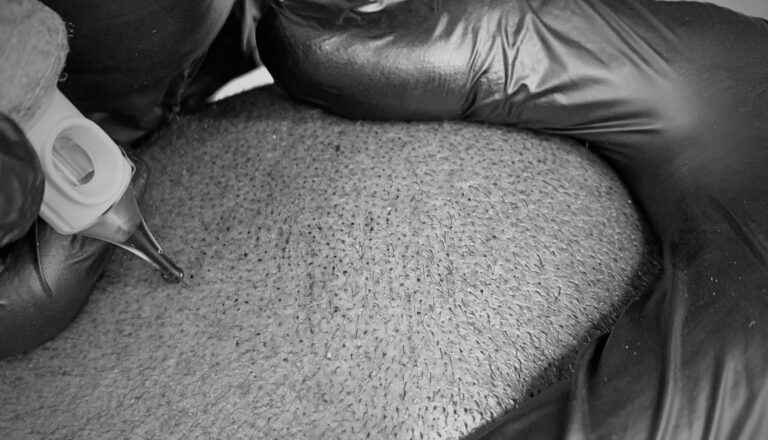 Step 1: Book Your Free SMP Consultation - Tailored Ink Toronto
